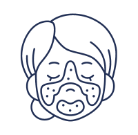 rosacea Consultas de Dermatología por Telemedicina